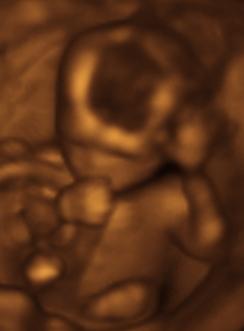 4.5 Month Old Sucking His Thumb and Waving